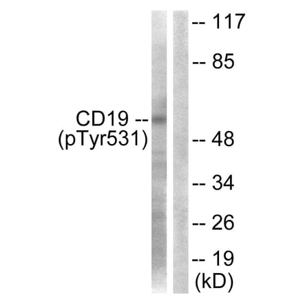 Western Blot - Anti-CD19 (phospho Tyr531) Antibody (A0412) - Antibodies.com