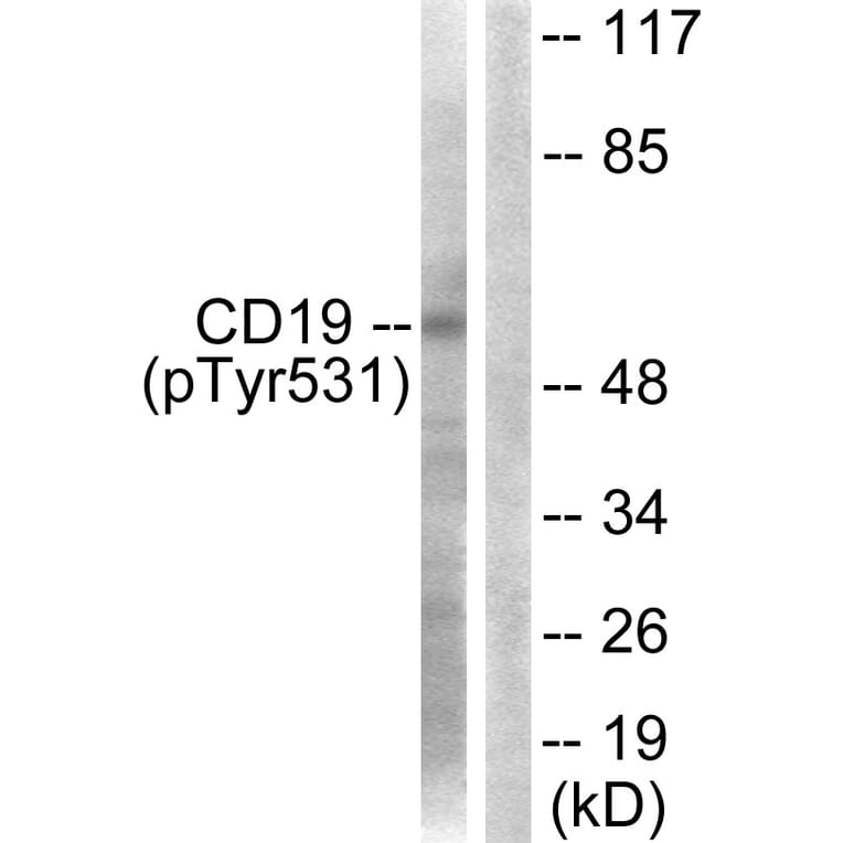 Western Blot - Anti-CD19 (phospho Tyr531) Antibody (A0412) - Antibodies.com