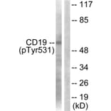 Western Blot - Anti-CD19 (phospho Tyr531) Antibody (A0412) - Antibodies.com