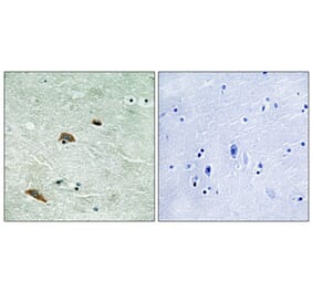 Immunohistochemistry - Anti-TTK (phospho Thr676) Antibody (A8197) - Antibodies.com