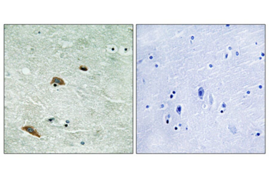 Immunohistochemistry - Anti-TTK (phospho Thr676) Antibody (A8197) - Antibodies.com