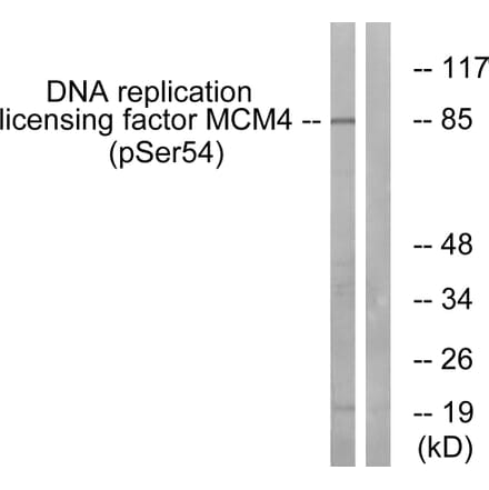Western Blot - Anti-MCM4 (phospho Ser54) Antibody (A0905) - Antibodies.com