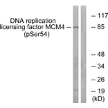 Western Blot - Anti-MCM4 (phospho Ser54) Antibody (A0905) - Antibodies.com