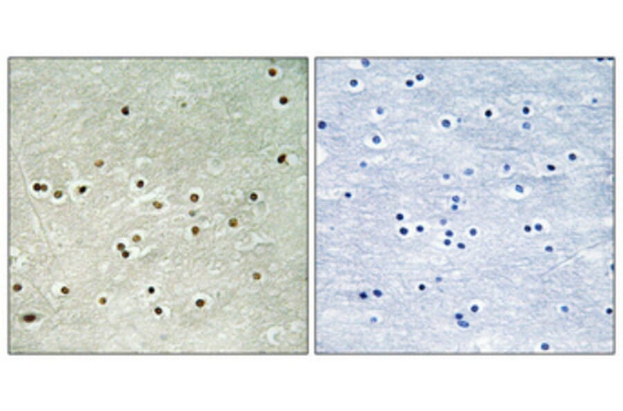 Immunohistochemistry - Anti-MCM4 (phospho Ser54) Antibody (A0905) - Antibodies.com