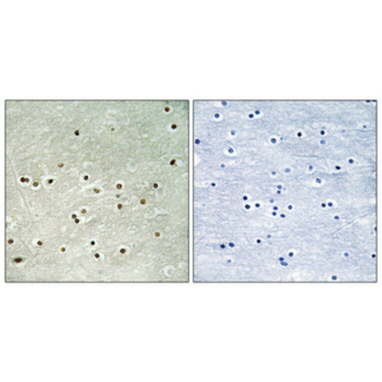 Immunohistochemistry - Anti-MCM4 (phospho Ser54) Antibody (A0905) - Antibodies.com