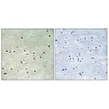 Immunohistochemistry - Anti-MCM4 (phospho Ser54) Antibody (A0905) - Antibodies.com