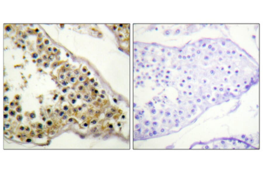 Immunohistochemistry - Anti-ITK (phospho Tyr512) Antibody (A1079) - Antibodies.com