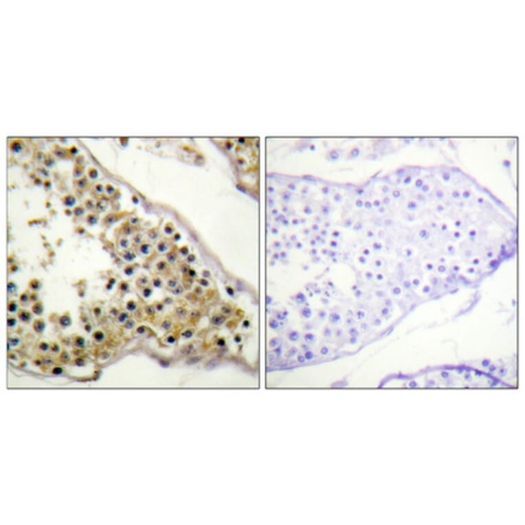 Immunohistochemistry - Anti-ITK (phospho Tyr512) Antibody (A1079) - Antibodies.com