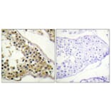 Immunohistochemistry - Anti-ITK (phospho Tyr512) Antibody (A1079) - Antibodies.com