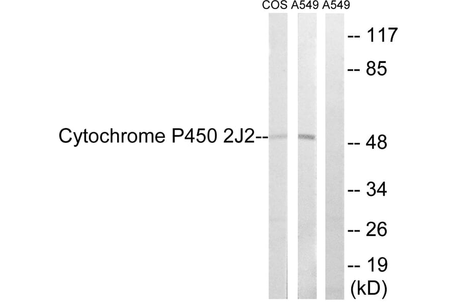 Western Blot - Anti-Cytochrome P450 2J2 Antibody (C12269) - Antibodies.com