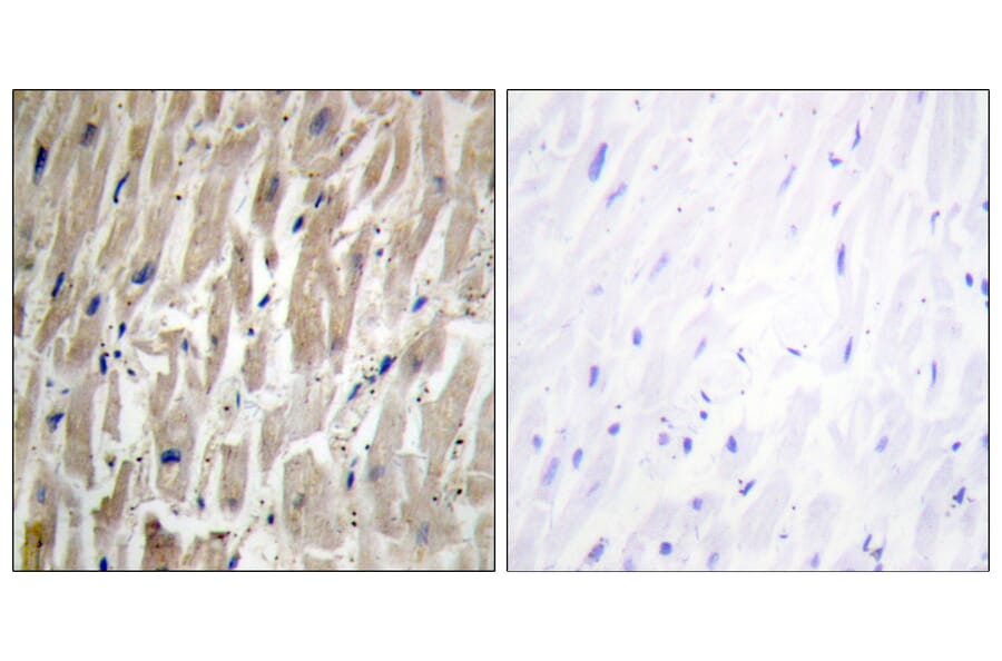 Immunohistochemistry - Anti-Cytochrome P450 2J2 Antibody (C12269) - Antibodies.com