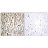Immunohistochemistry - Anti-Cytochrome P450 2J2 Antibody (C12269) - Antibodies.com