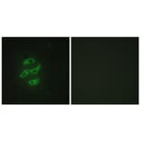 Immunofluorescence - Anti-Cytochrome P450 2J2 Antibody (C12269) - Antibodies.com