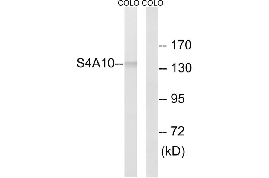Western Blot - Anti-SLC4A8 + SLC4A10 Antibody (C18874) - Antibodies.com