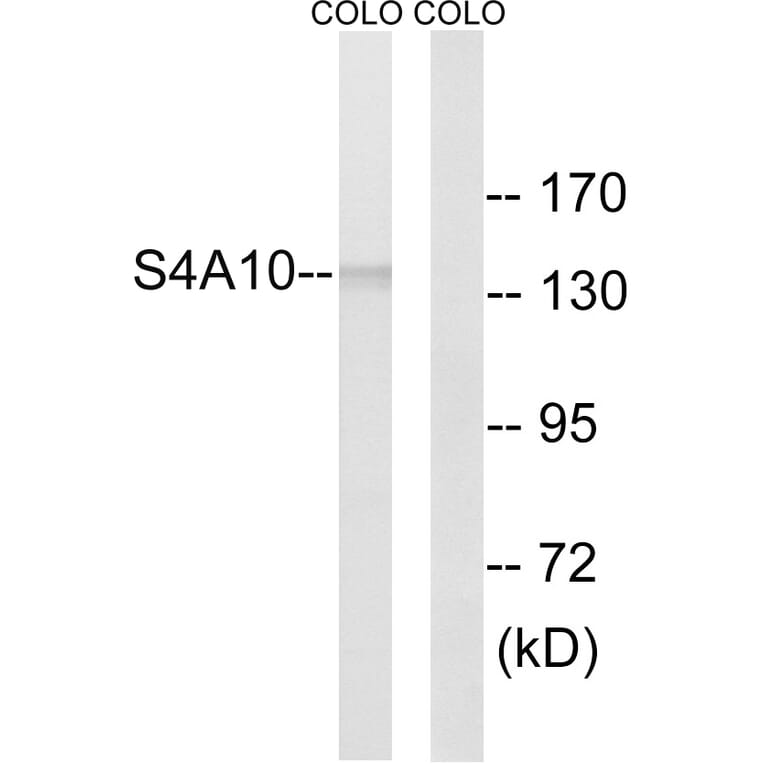 Western Blot - Anti-SLC4A8 + SLC4A10 Antibody (C18874) - Antibodies.com