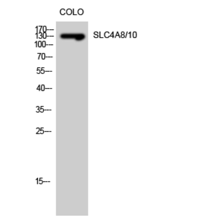 Western Blot - Anti-SLC4A8 + SLC4A10 Antibody (C18874) - Antibodies.com