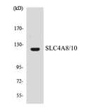 Western Blot - Anti-SLC4A8 + SLC4A10 Antibody (R12-3533) - Antibodies.com