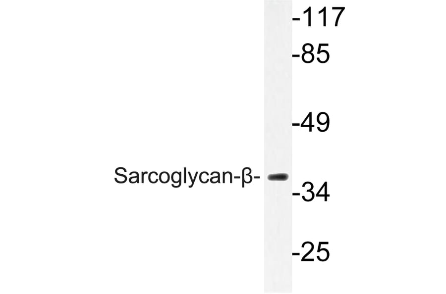 Western Blot - Anti-Sarcoglycan-beta Antibody (R12-2345) - Antibodies.com