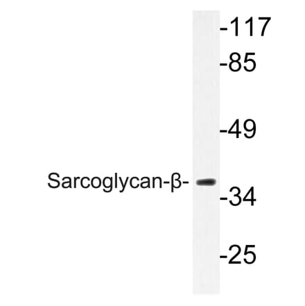 Western Blot - Anti-Sarcoglycan-beta Antibody (R12-2345) - Antibodies.com