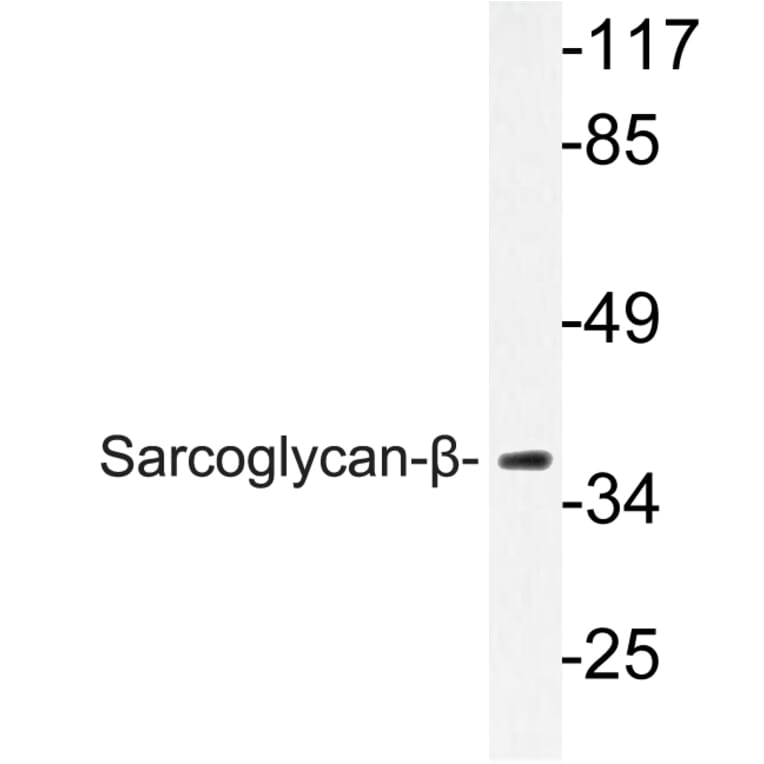 Western Blot - Anti-Sarcoglycan-beta Antibody (R12-2345) - Antibodies.com