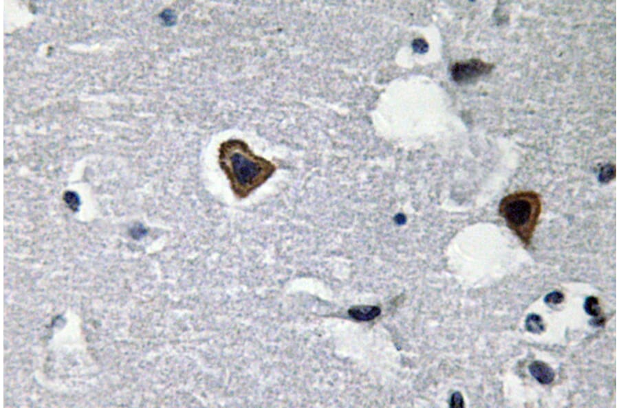 Immunohistochemistry - Anti-Sarcoglycan-beta Antibody (R12-2345) - Antibodies.com