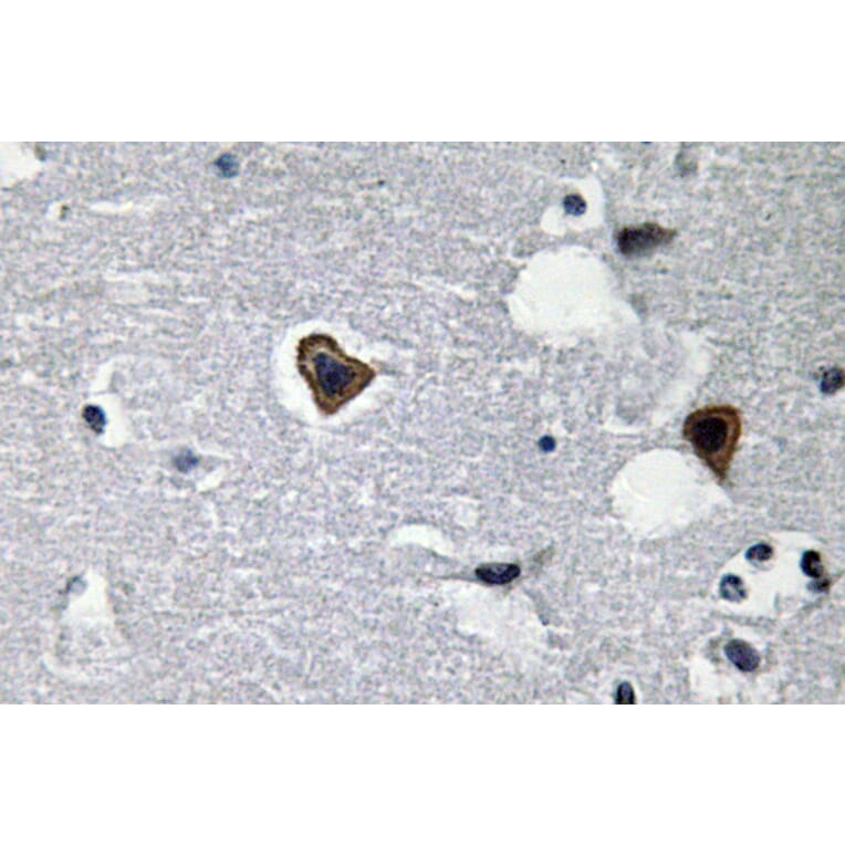 Immunohistochemistry - Anti-Sarcoglycan-beta Antibody (R12-2345) - Antibodies.com