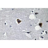 Immunohistochemistry - Anti-Sarcoglycan-beta Antibody (R12-2345) - Antibodies.com