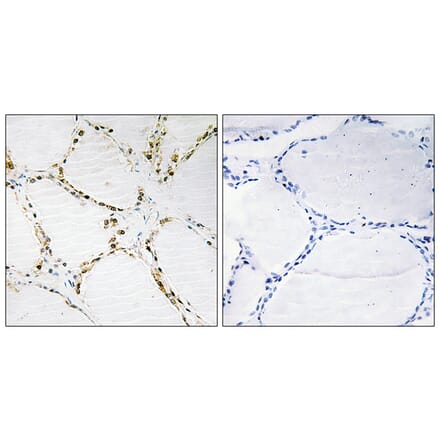 Immunohistochemistry - Anti-FOXO1A + FOXO3A Antibody (B0485) - Antibodies.com
