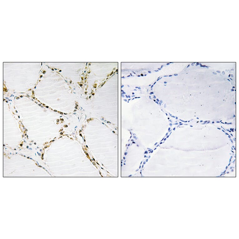 Immunohistochemistry - Anti-FOXO1A + FOXO3A Antibody (B0485) - Antibodies.com