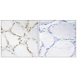 Immunohistochemistry - Anti-FOXO1A + FOXO3A Antibody (B0485) - Antibodies.com