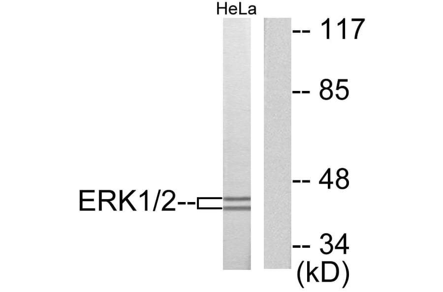 Western Blot - Anti-p44/42 MAPK Antibody (C0185) - Antibodies.com