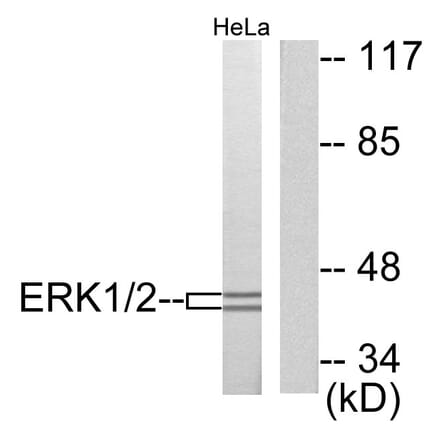 Western Blot - Anti-p44/42 MAPK Antibody (C0185) - Antibodies.com