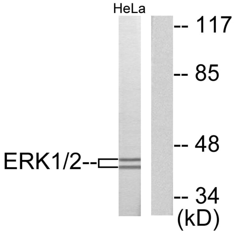 Western Blot - Anti-p44/42 MAPK Antibody (C0185) - Antibodies.com