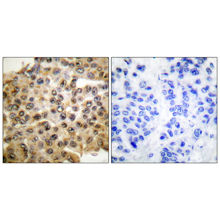Immunohistochemistry - Anti-p44/42 MAPK Antibody (C0185) - Antibodies.com
