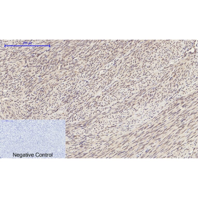 Immunohistochemistry - Anti-p44/42 MAPK Antibody (C0185) - Antibodies.com