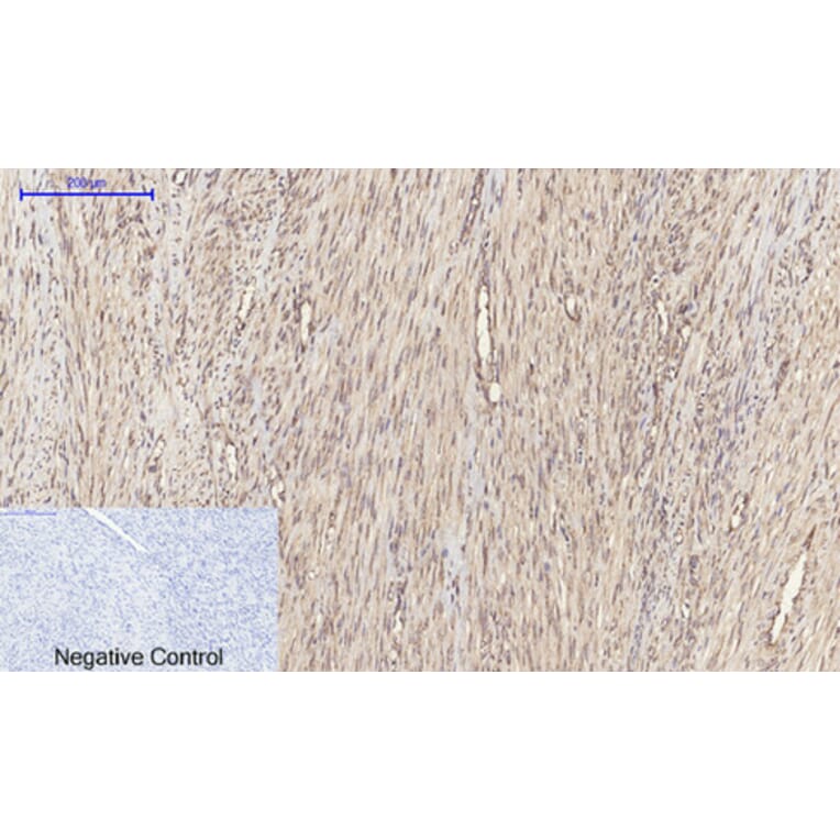 Immunohistochemistry - Anti-p44/42 MAPK Antibody (C0185) - Antibodies.com