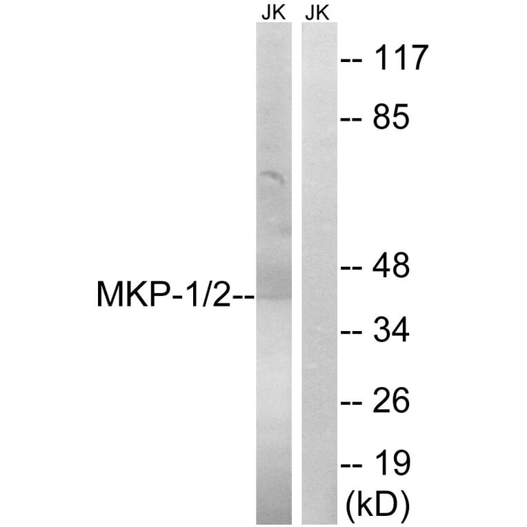 Western Blot - Anti-MKP1 + MKP2 Antibody (B8372) - Antibodies.com