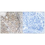 Immunohistochemistry - Anti-MKP1 + MKP2 Antibody (B8372) - Antibodies.com