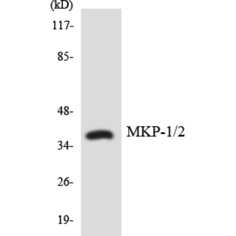 Western Blot - Anti-MKP1 + MKP2 Antibody (R12-3020) - Antibodies.com