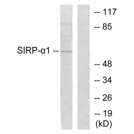 Western Blot - Anti-Sirp alpha1 Antibody (C0322) - Antibodies.com