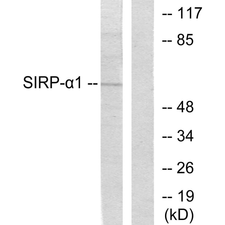 Western Blot - Anti-Sirp alpha1 Antibody (C0322) - Antibodies.com