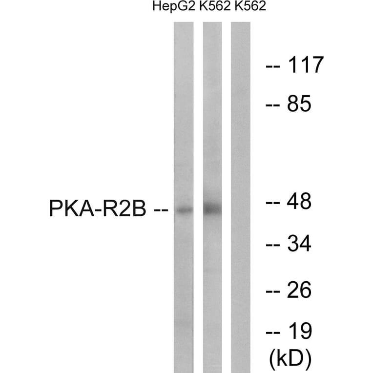 Western Blot - Anti-PKA-R2 beta Antibody (B0972) - Antibodies.com