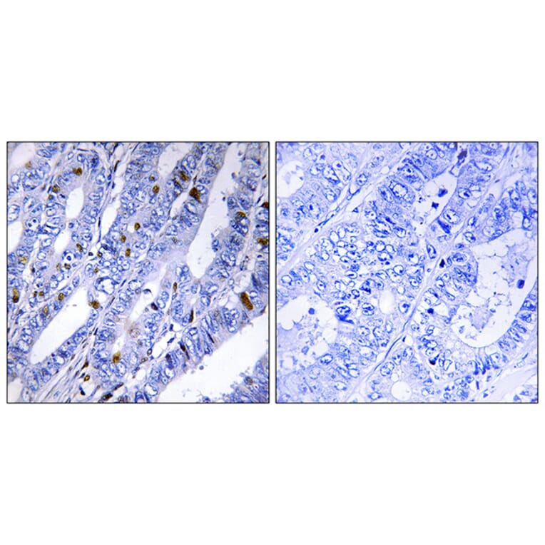 Immunohistochemistry - Anti-PKA-R2 beta Antibody (B0972) - Antibodies.com