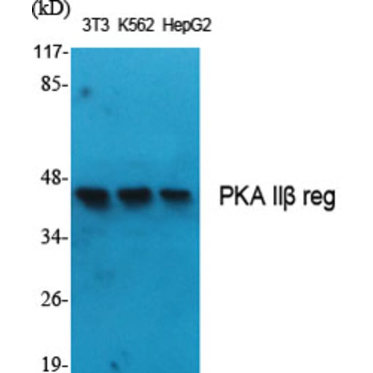 Western Blot - Anti-PKA-R2 beta Antibody (B0972) - Antibodies.com