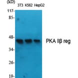 Western Blot - Anti-PKA-R2 beta Antibody (B0972) - Antibodies.com