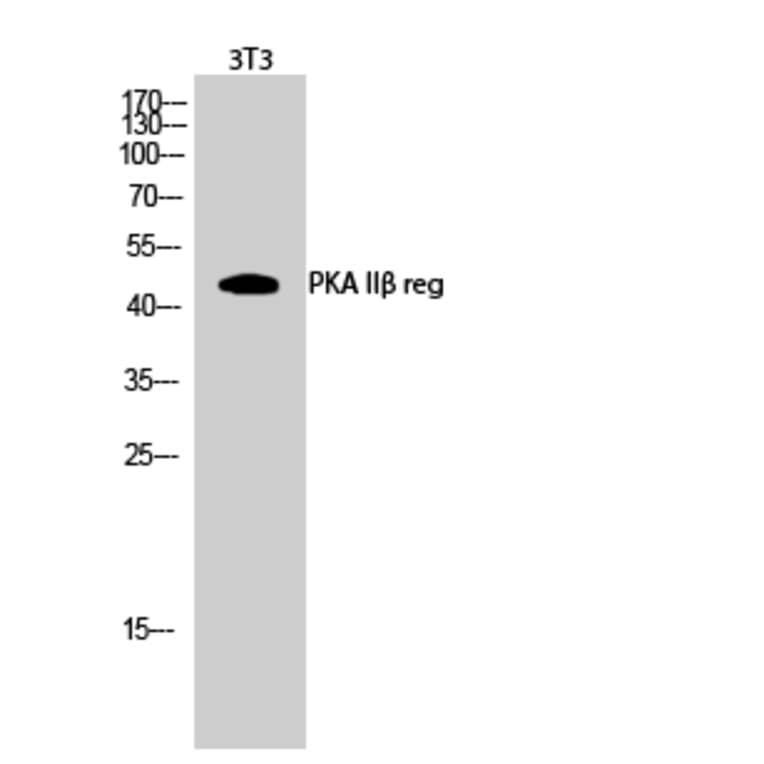 Western Blot - Anti-PKA-R2 beta Antibody (B0972) - Antibodies.com