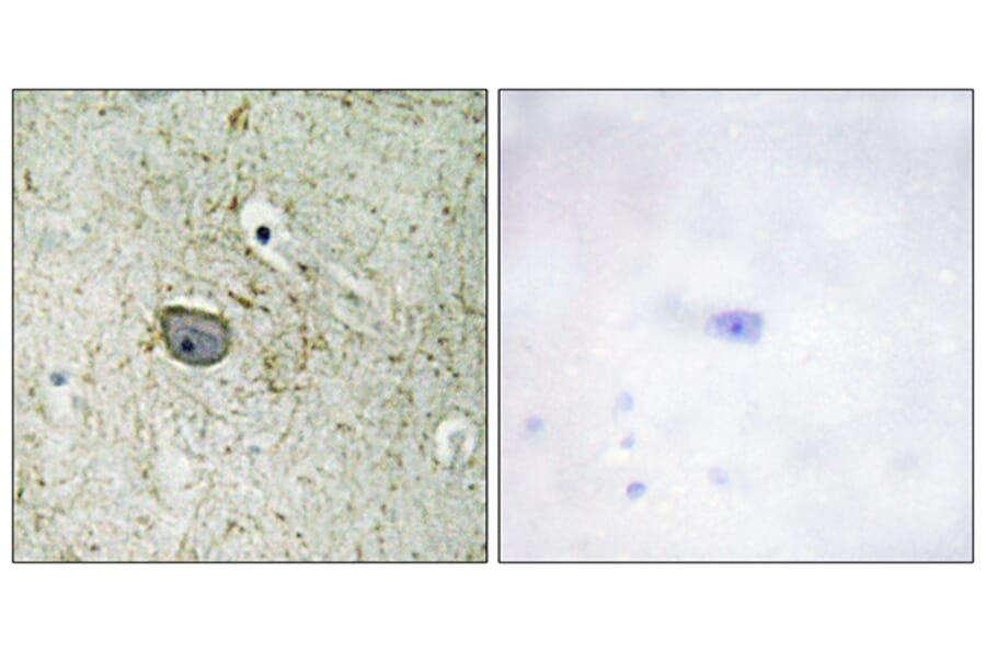 Immunohistochemistry - Anti-PDGFR alpha Antibody (B0968) - Antibodies.com