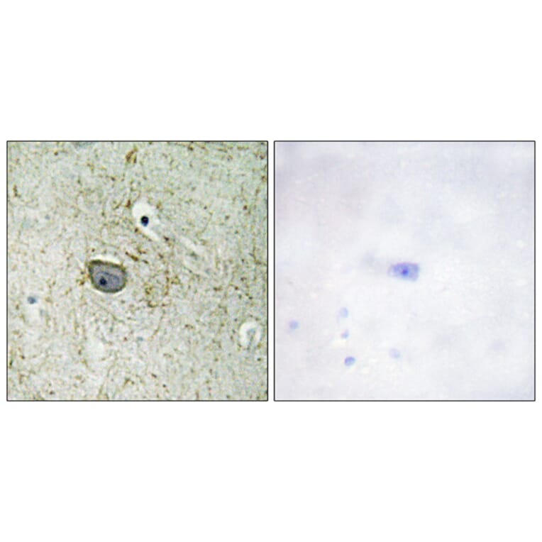 Immunohistochemistry - Anti-PDGFR alpha Antibody (B0968) - Antibodies.com
