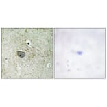 Immunohistochemistry - Anti-PDGFR alpha Antibody (B0968) - Antibodies.com