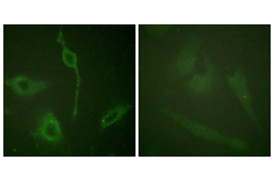 Immunofluorescence - Anti-PDGFR alpha Antibody (B0968) - Antibodies.com